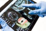 Army Hospital uses 3D printing for maxillofacial surgery 3D printing