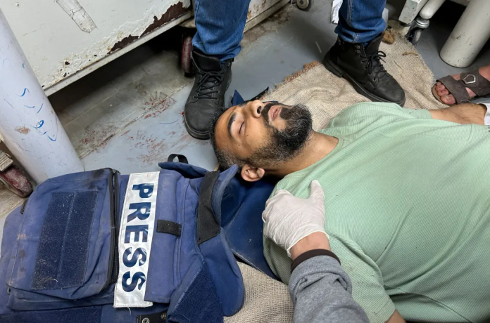 image Palestinian journalist Sami Shehadeh, wounded in an Israeli strike, lies on the floor at Al-Aqsa hospital in Deir al-Balah in the central Gaza Strip on April 12. (Photo: Reuters/Doaa Rouqa vis CPJ)